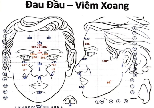 Diện Chẩn và hiệu quả điều trị viêm xoang – Giải pháp an toàn, tiết kiệm